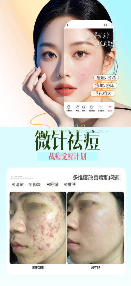 源文件下载【享设计】搜索编号：37320034813705187【微针祛痘】