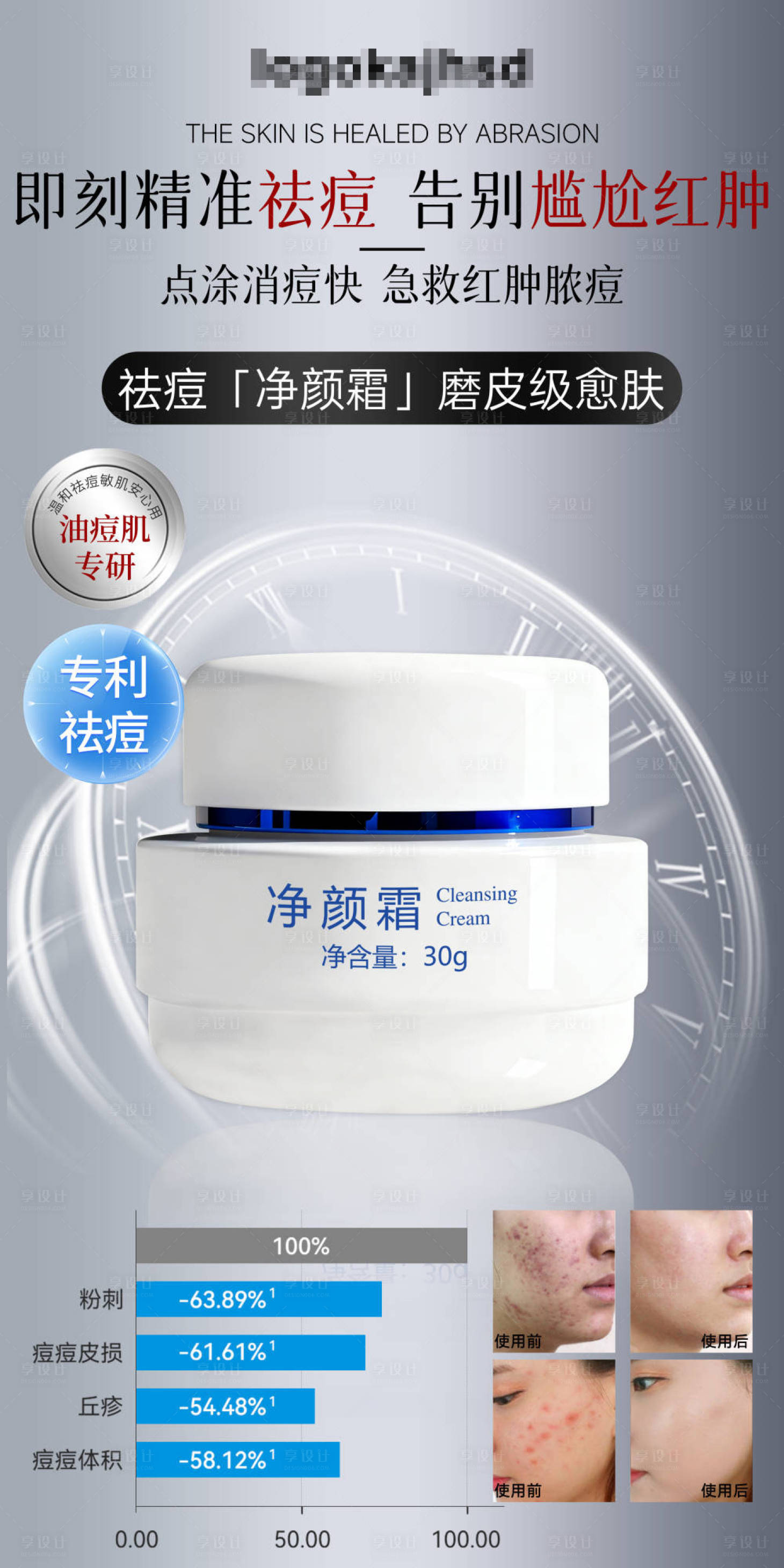 源文件下载【享设计】搜索编号：42910035077388678【祛痘面霜海报】