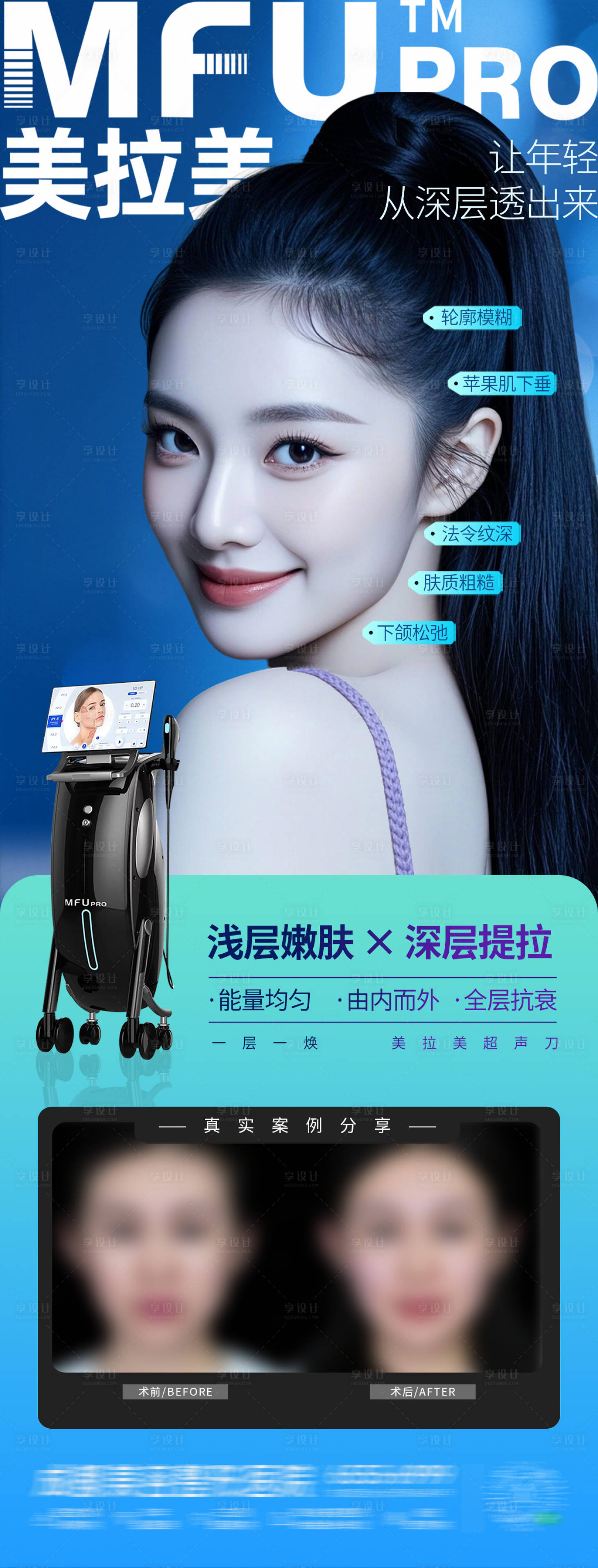 源文件下载【享设计】搜索编号：32730034869597650【医美美拉美仪器轮廓抗衰案例创意海报】