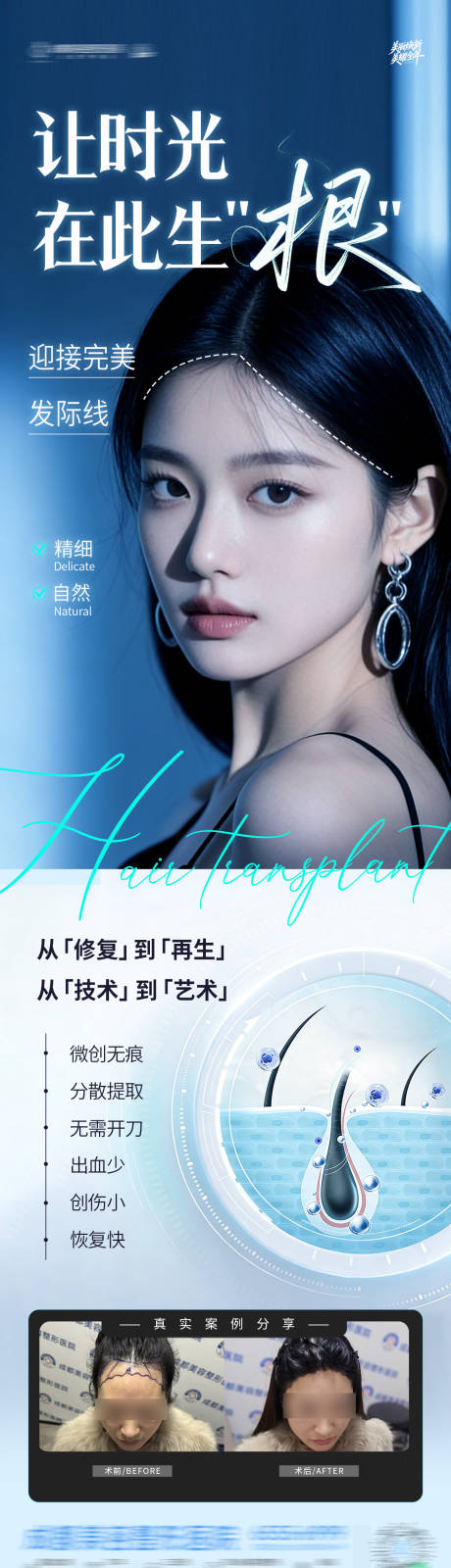 源文件下载【享设计】搜索编号：10790034903982321【发际线地中海植发案例创意海报】