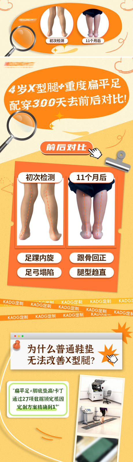 源文件下载【享设计】搜索编号：72680035119957008【4岁X型腿（长图）】