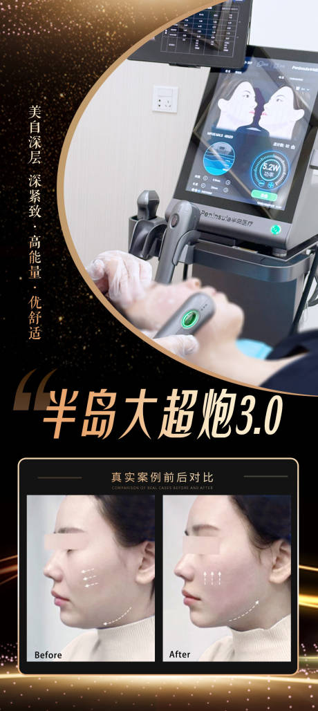 源文件下载【享设计】搜索编号：71820034963686259【医美半岛大超炮案例海报】