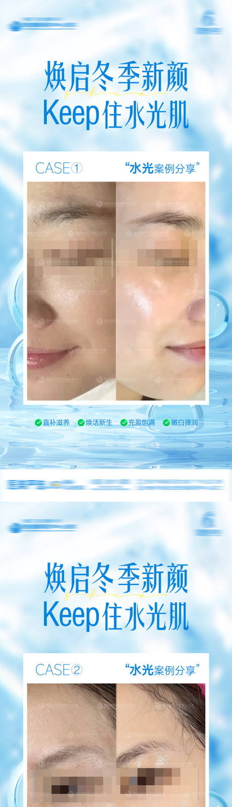 源文件下载【享设计】搜索编号：91790034994758277【医美整形冬季补水水光肌案例对比海报】