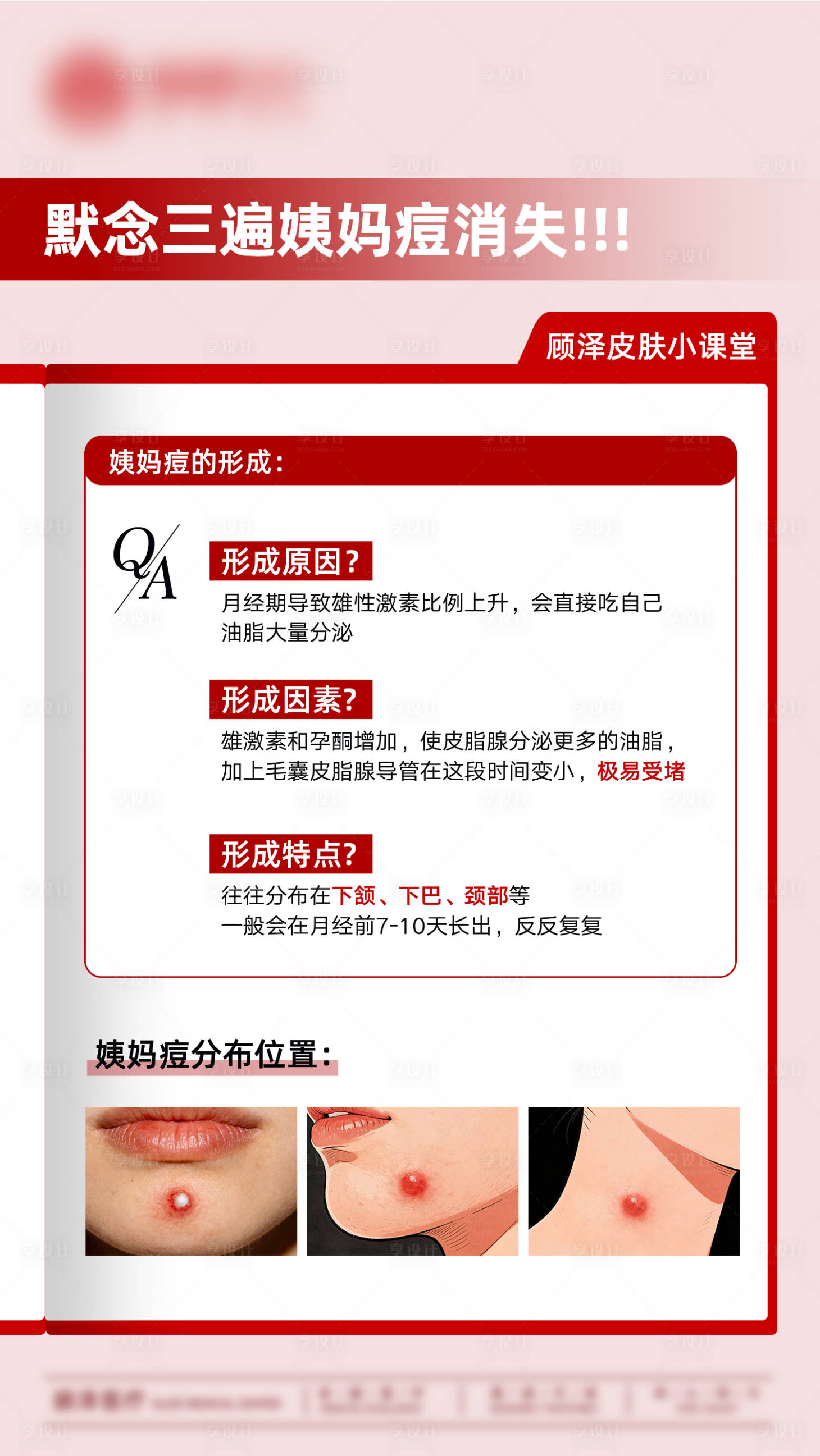 源文件下载【享设计】搜索编号：57800035136909469【默念三遍姨妈痘消失 】