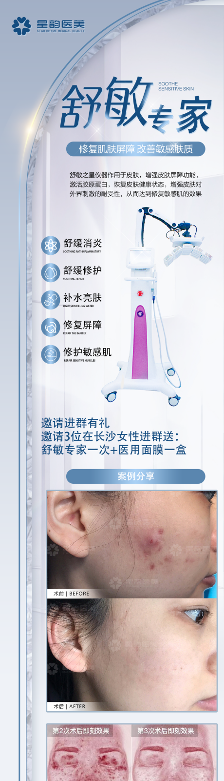 源文件下载【享设计】搜索编号：27120034966274302【医美皮肤舒敏之星舒敏专家半岛仪器长图】