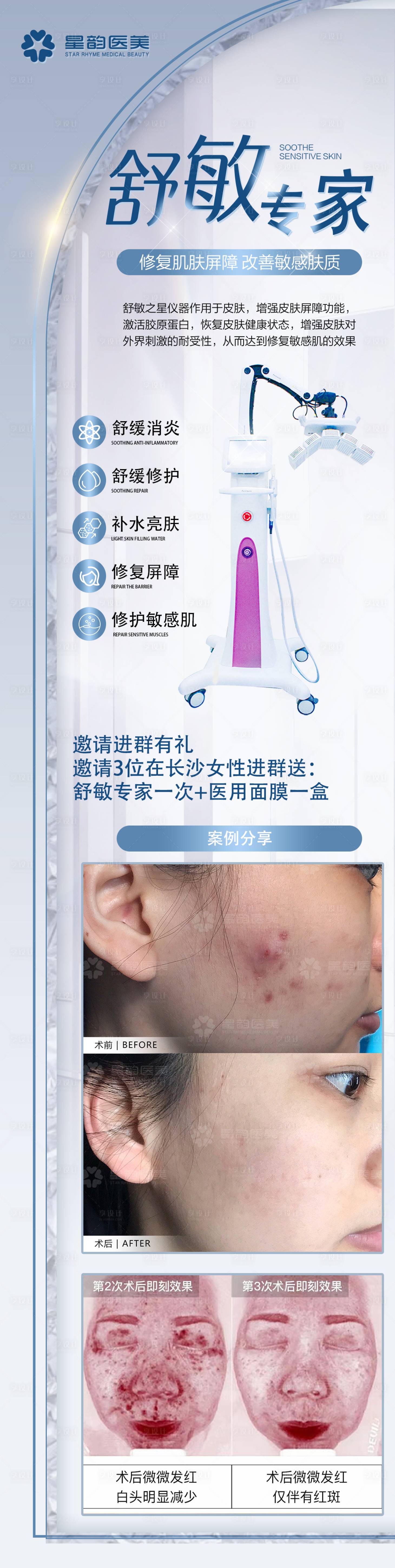 源文件下载【享设计】搜索编号：27120034966274302【医美皮肤舒敏之星舒敏专家半岛仪器长图】