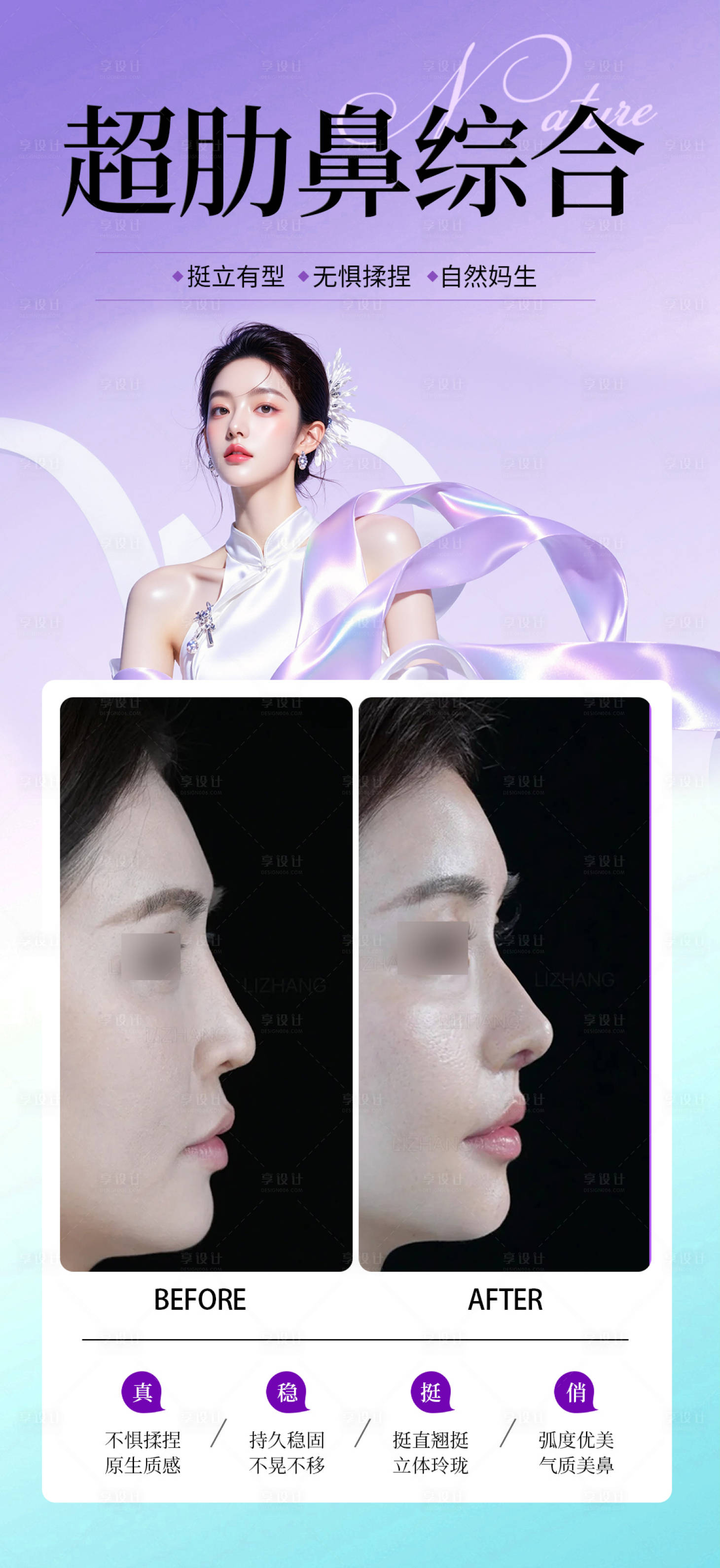 源文件下载【享设计】搜索编号：93320034812518432【医美超肋鼻综合案例海报】