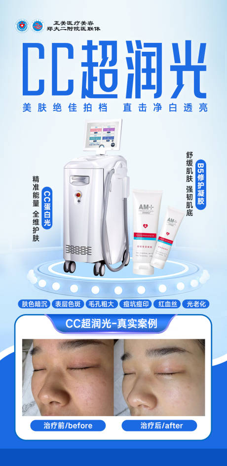 源文件下载【享设计】搜索编号：56180034814514542【医美CC超润光海报】