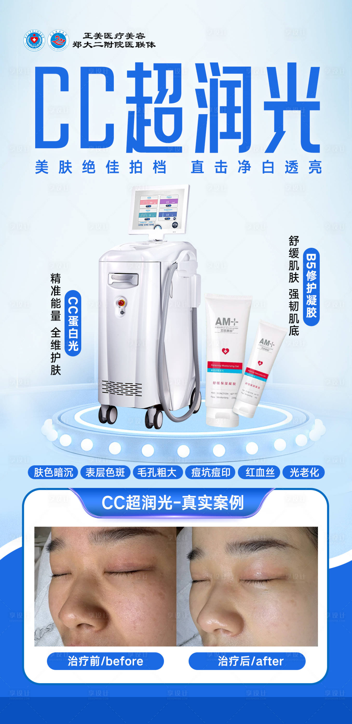 源文件下载【享设计】搜索编号：56180034814514542【医美CC超润光海报】