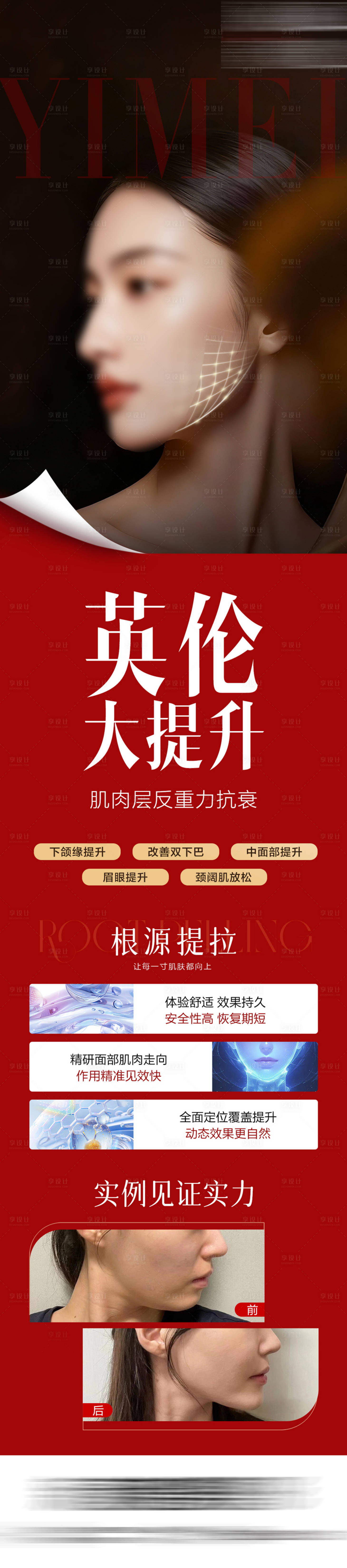 源文件下载【享设计】搜索编号：73250034821705924【医美英伦大提升海报】