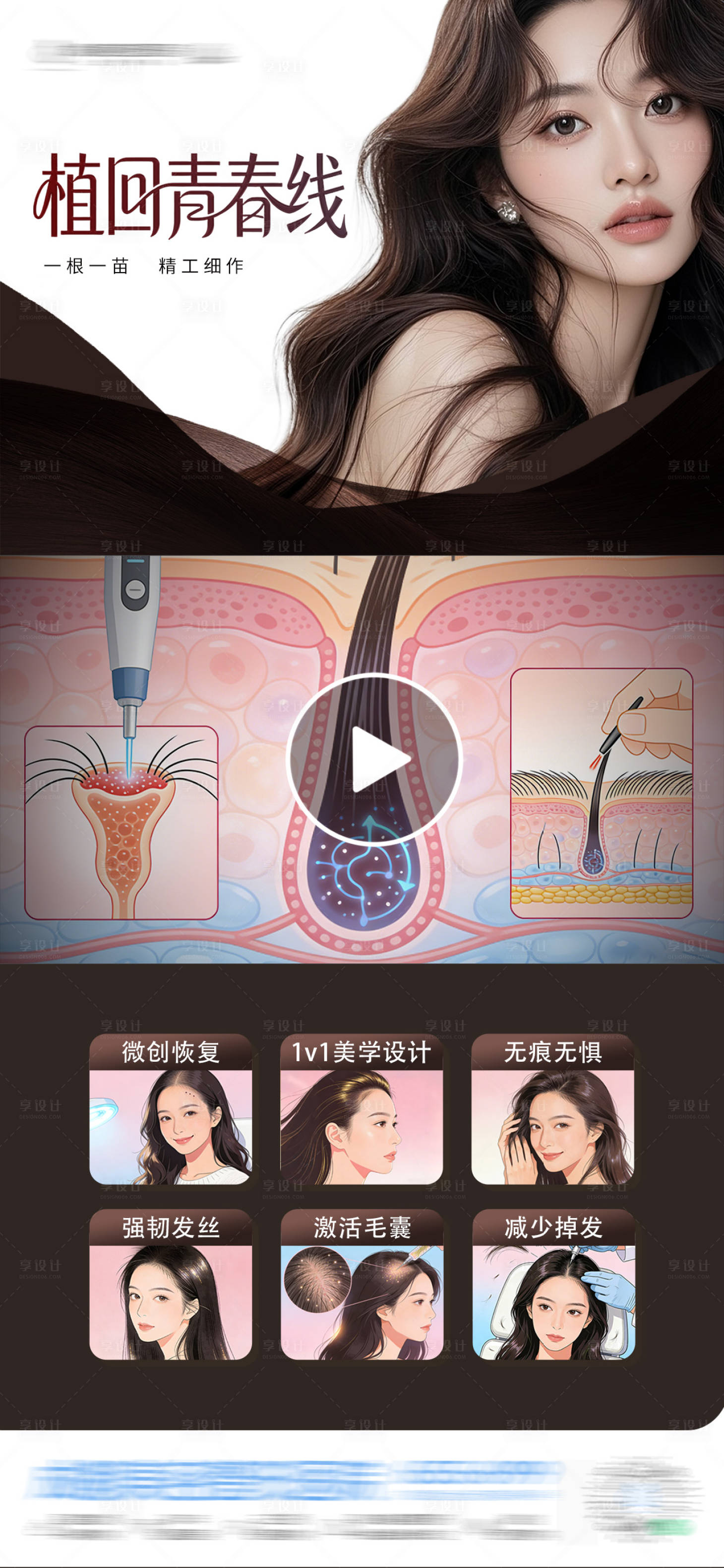 源文件下载【享设计】搜索编号：41390035118847989【医美发际线地中海植发治疗插画创意视频】