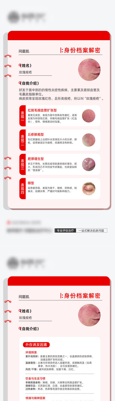 源文件下载【享设计】搜索编号：77210035032903703【医美玫瑰痤疮科普海报】