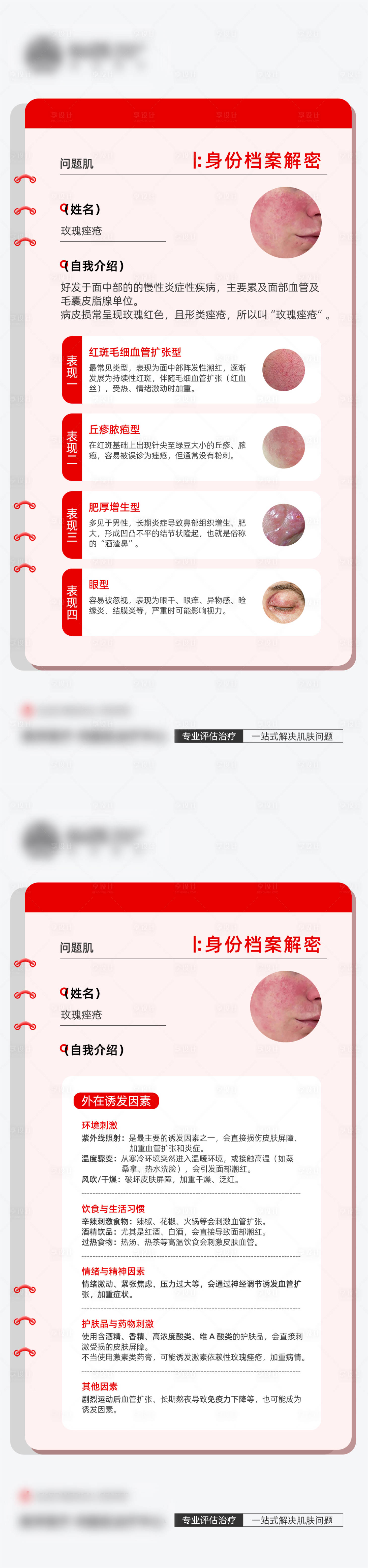 源文件下载【享设计】搜索编号：77210035032903703【医美玫瑰痤疮科普海报】