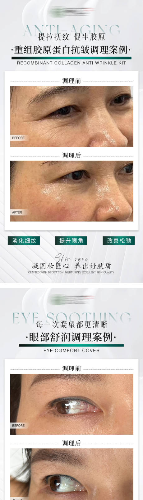 源文件下载【享设计】搜索编号：73750035306574919【医美项目案例对比图】