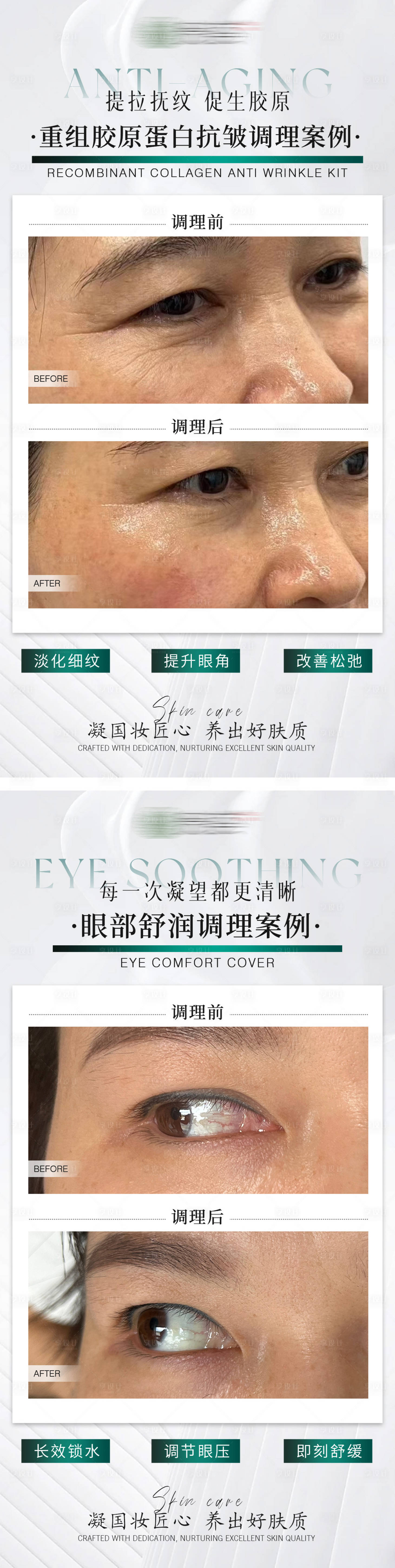 源文件下载【享设计】搜索编号：73750035306574919【医美项目案例对比图】