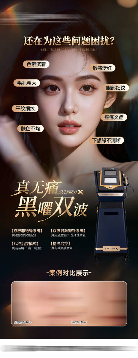 源文件下载【享设计】搜索编号：27690034850509782【黑曜双波黄金全能针】