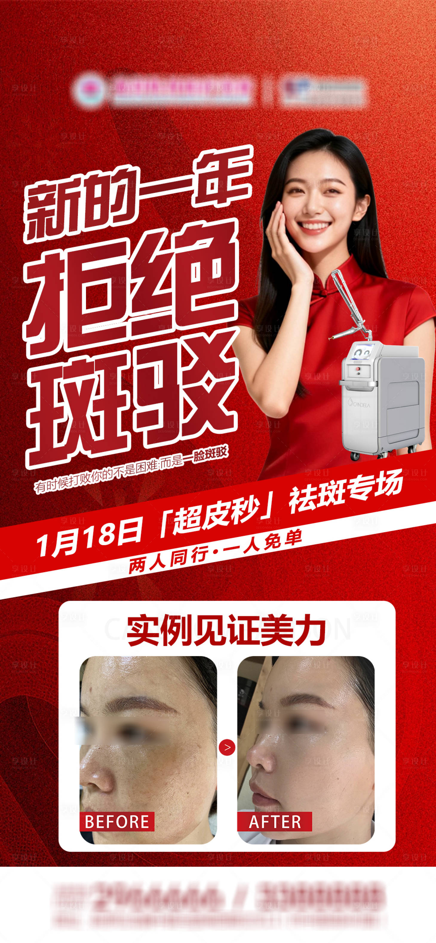 源文件下载【享设计】搜索编号：67640034909088016【医美新春超秒祛斑专案例日常早安海报】