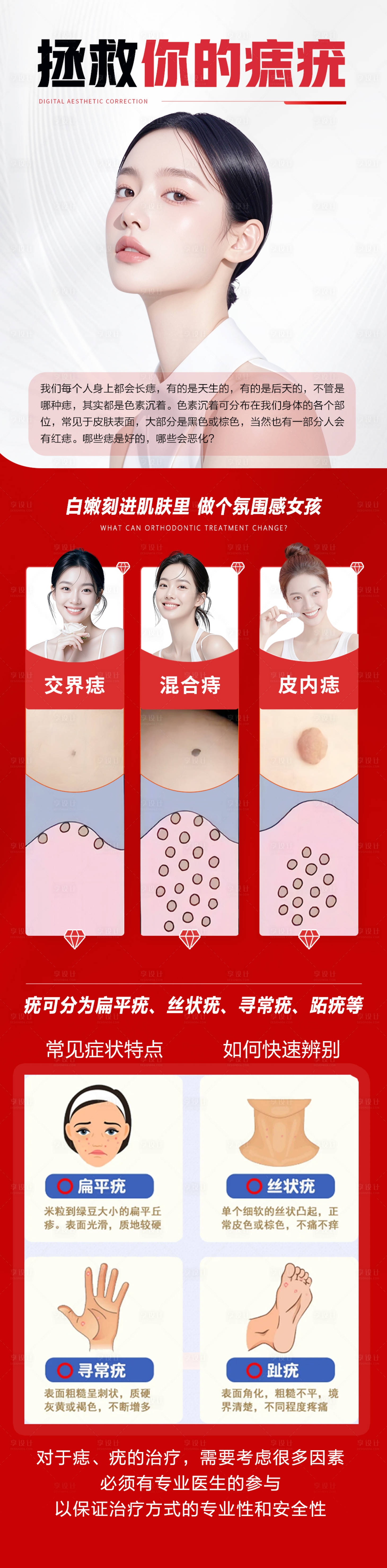 源文件下载【享设计】搜索编号：55760034903369087【痣疣去除宣传海报长图】