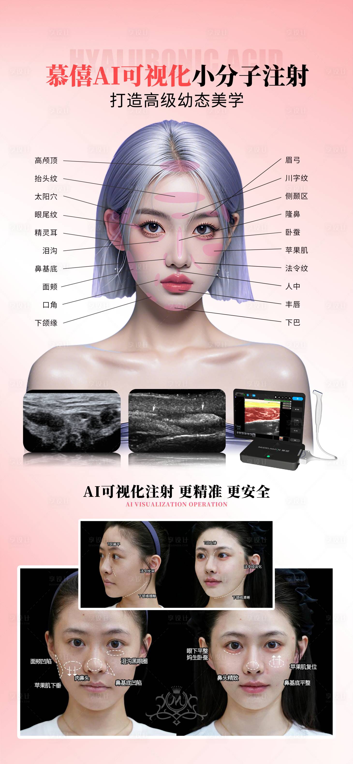 源文件下載【享設(shè)計】搜索編號：84110035195566523【醫(yī)美玻尿酸填充】