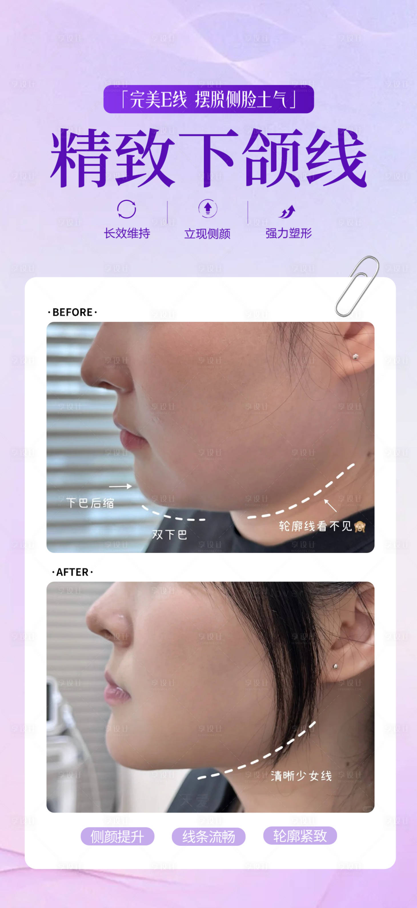 源文件下载【享设计】搜索编号：47290035268554598【精致下颌线】