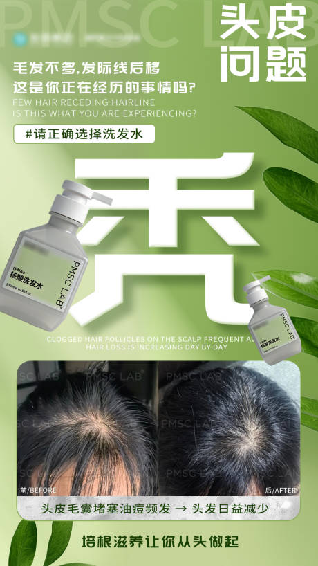 源文件下载【享设计】搜索编号：55820035130737896【头皮问题】