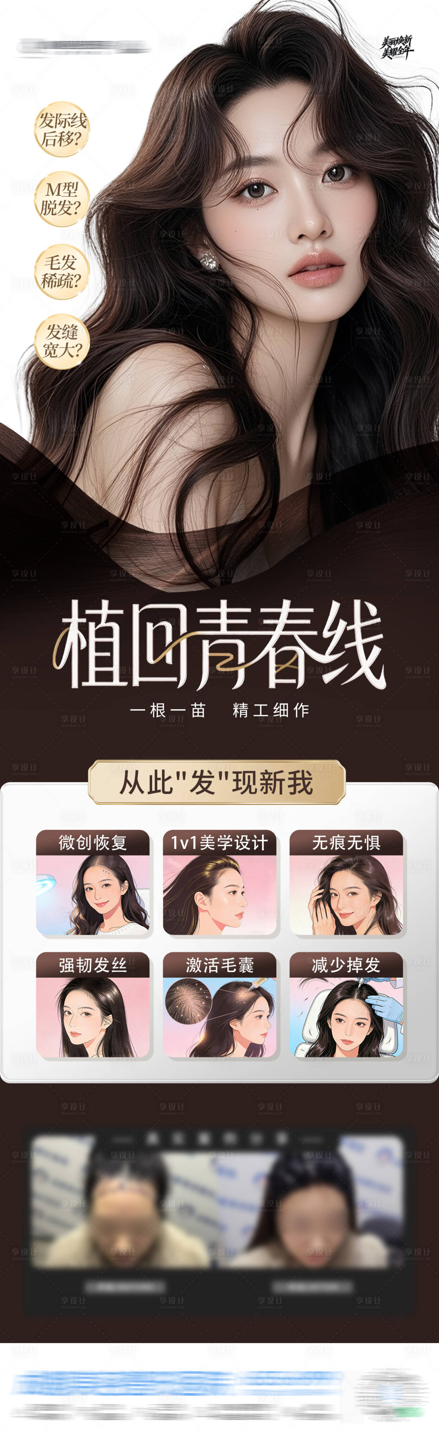 源文件下载【享设计】搜索编号：10060035117554898【医美发际线海报】