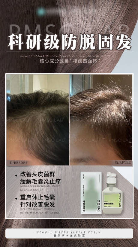 源文件下载【享设计】搜索编号：84570035215707042【科研级防脱固发】