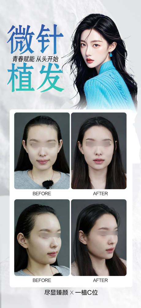 源文件下载【享设计】搜索编号：74720034812474437【医美微针植发案例海报】