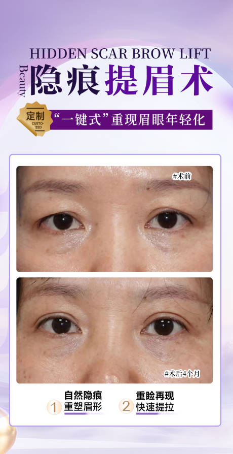 源文件下载【享设计】搜索编号：80880034871827756【隐痕提眉术】