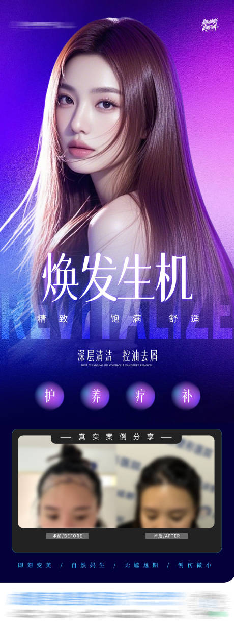 源文件下载【享设计】搜索编号：14450035056377003【医美发际线地中海治疗案例创意海报】