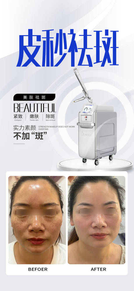 源文件下载【享设计】搜索编号：61950034813729938【皮秒祛斑】