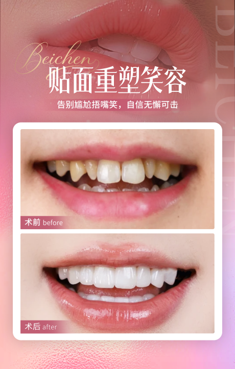 源文件下载【享设计】搜索编号：49450034809303835【案例海报】