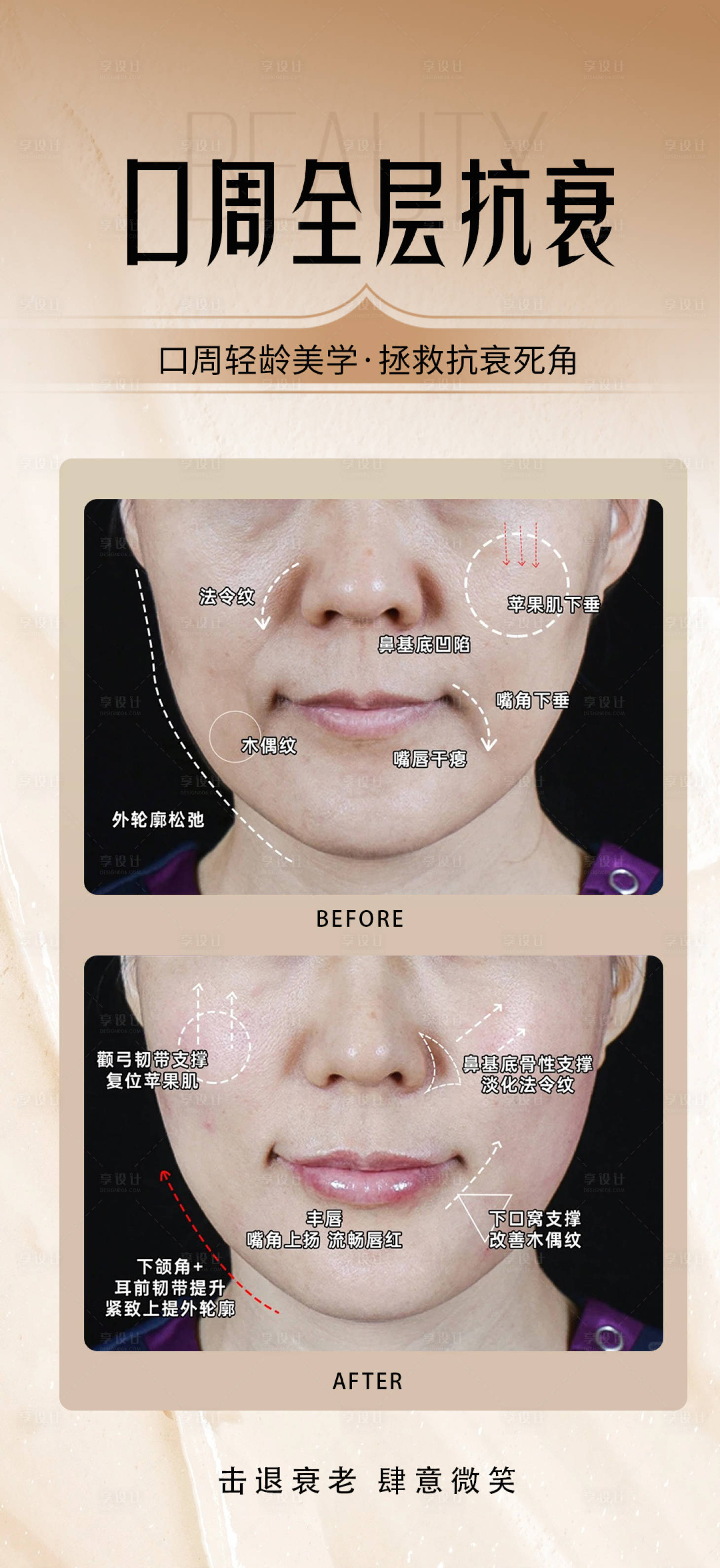 源文件下载【享设计】搜索编号：43170034812482110【医美口周全层抗衰海报】