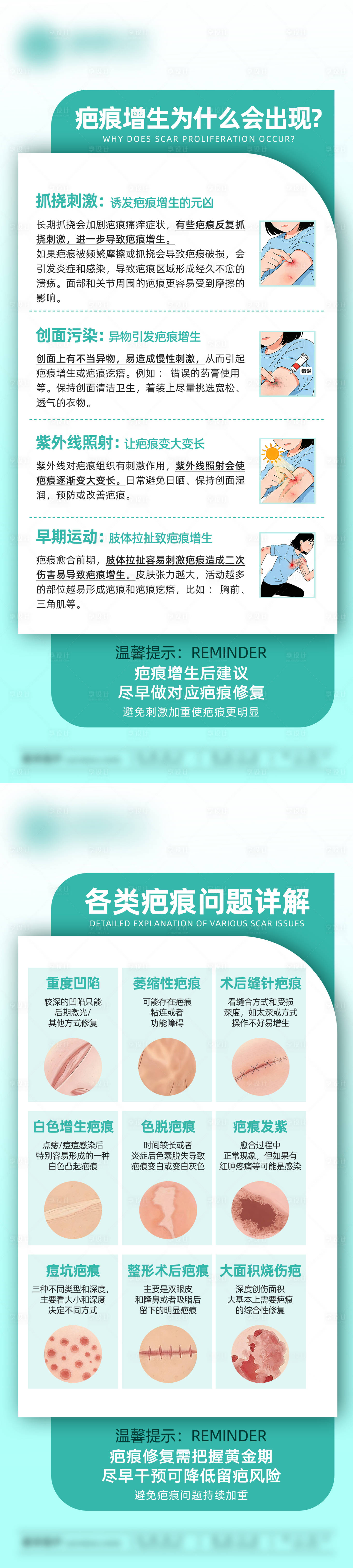 源文件下载【享设计】搜索编号：32670035046736227【疤痕问题详解科普疤痕增生】