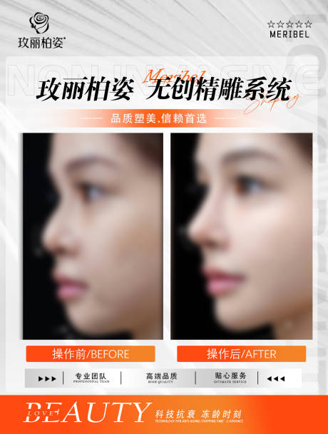 源文件下载【享设计】搜索编号：23730035226187662【医美案例图海报 】