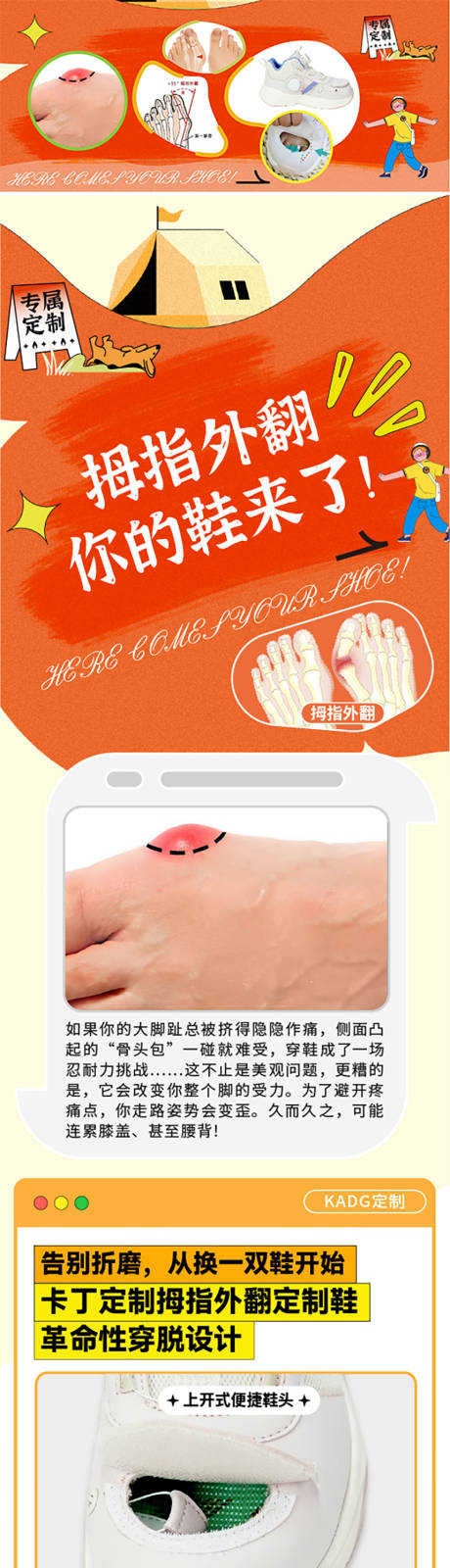 源文件下載【享設(shè)計(jì)】搜索編號：38770035122387748【拇指外翻】