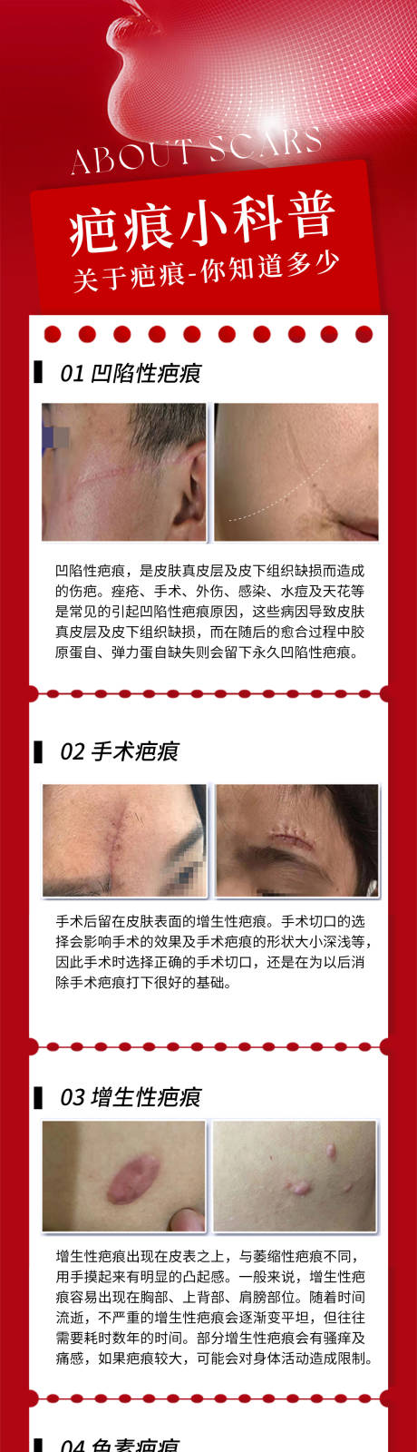 源文件下载【享设计】搜索编号：70930034898044143【疤痕科普长图海报】