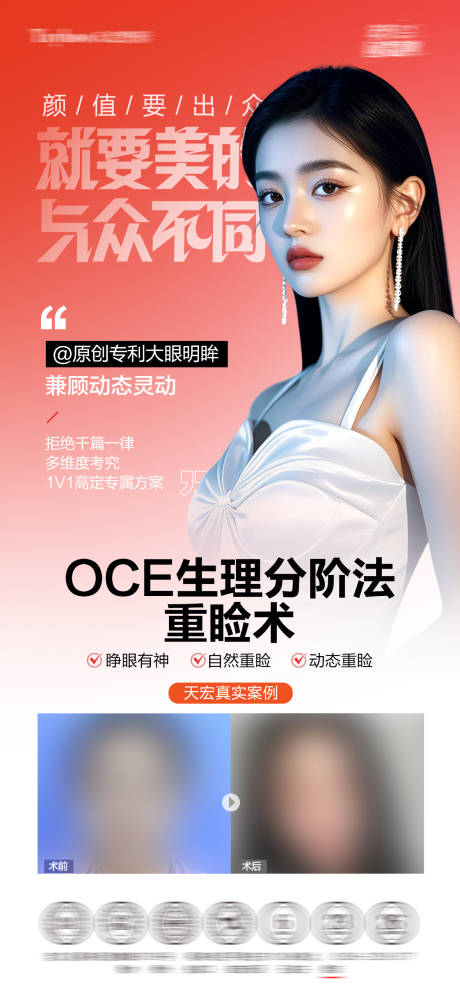 源文件下载【享设计】搜索编号：14430034824591036【oce双眼皮重睑术】