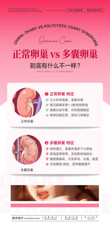 源文件下载【享设计】搜索编号：88750035153103482【卵巢科普海报】