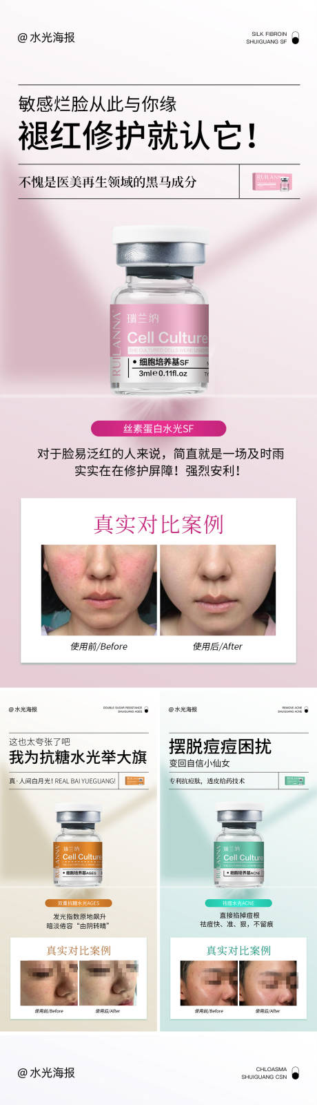 源文件下载【享设计】搜索编号：63760035223932613【医美对比图系列海报】