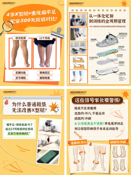 源文件下载【享设计】搜索编号：29810035119943614【4岁X型腿科普海报】