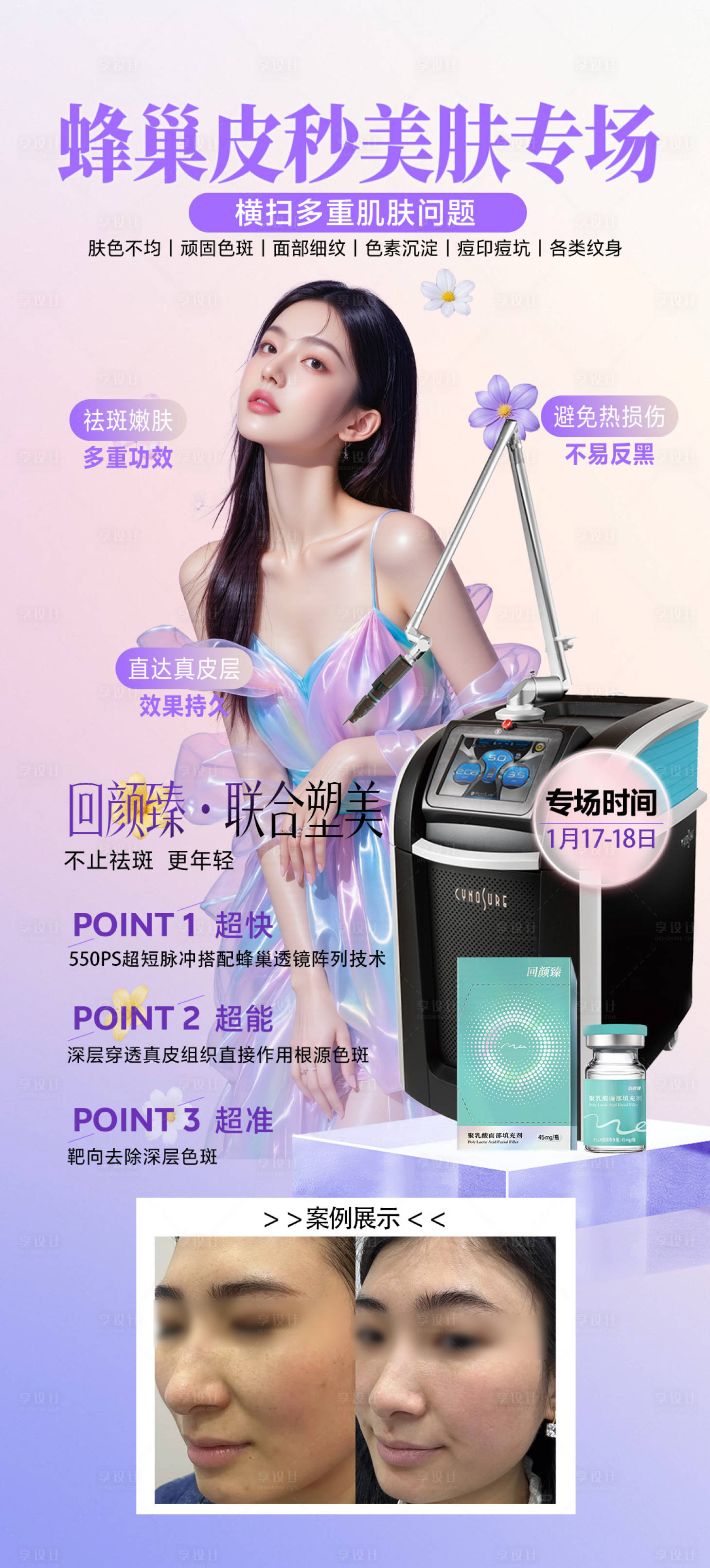 源文件下载【享设计】搜索编号：29360034934664626【蜂巢皮秒祛斑海报】