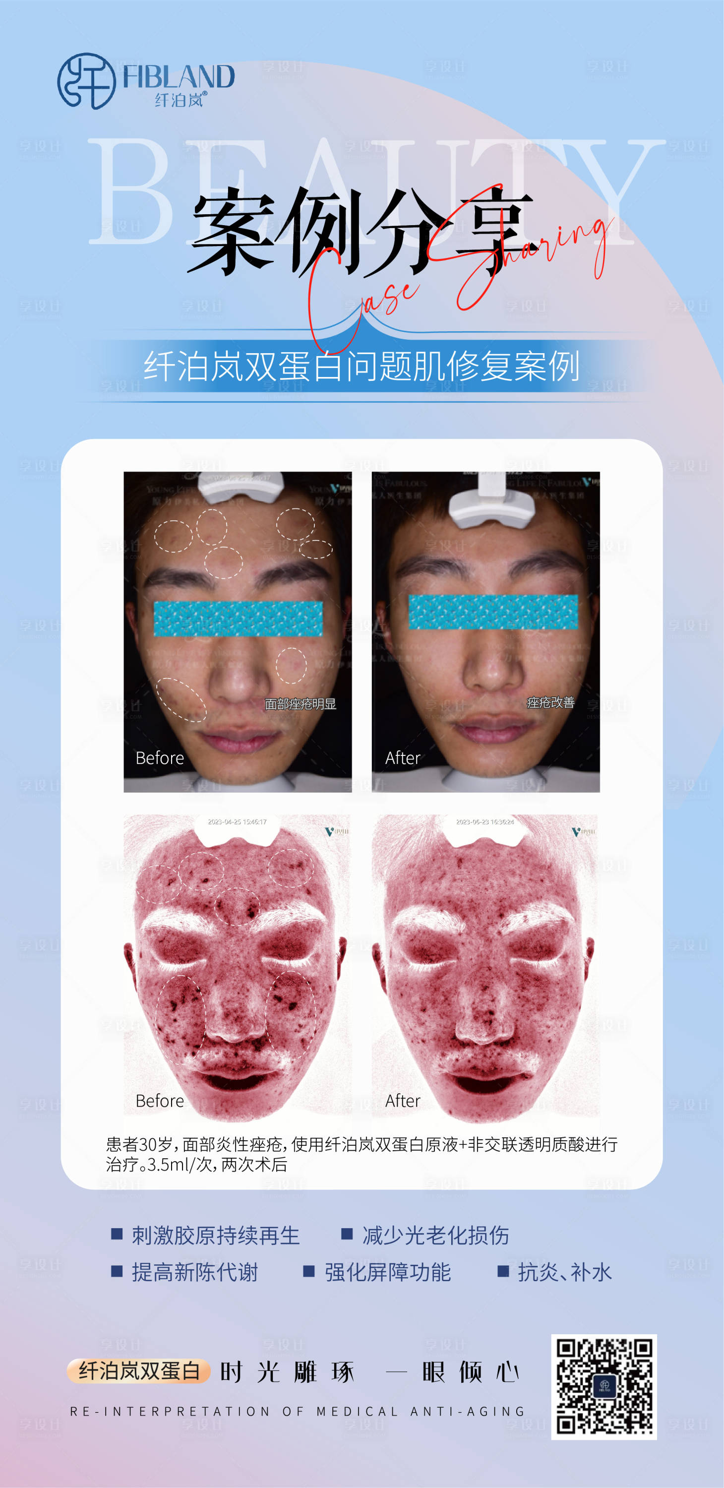 源文件下载【享设计】搜索编号：41580034942614620【纤泊岚双蛋白海报 】