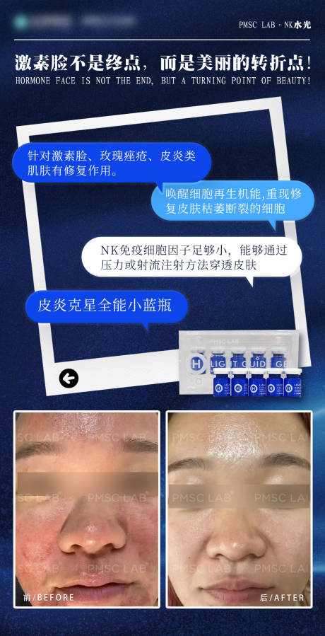 源文件下载【享设计】搜索编号：33000034840524827【医美产品海报】