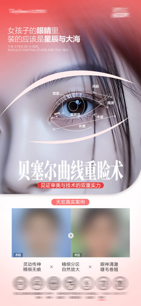 源文件下载【享设计】搜索编号：45460034824619280【双眼皮重睑术】