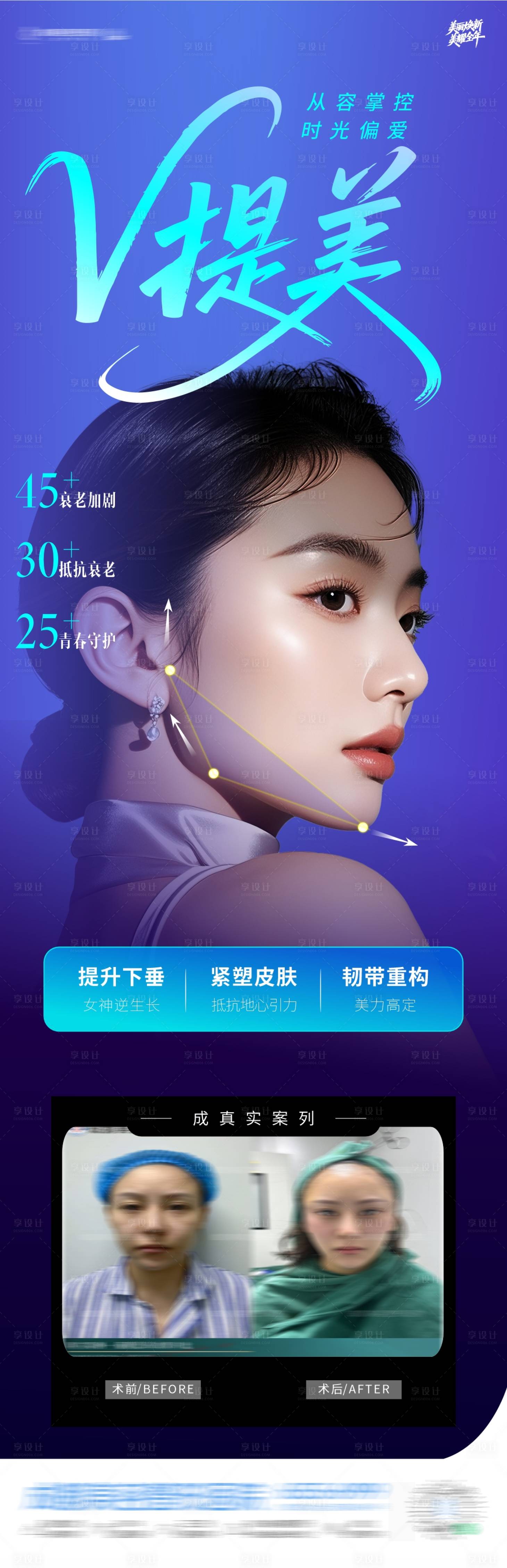源文件下载【享设计】搜索编号：24970035213005320【V提美面部塑形抗衰年轻海报】
