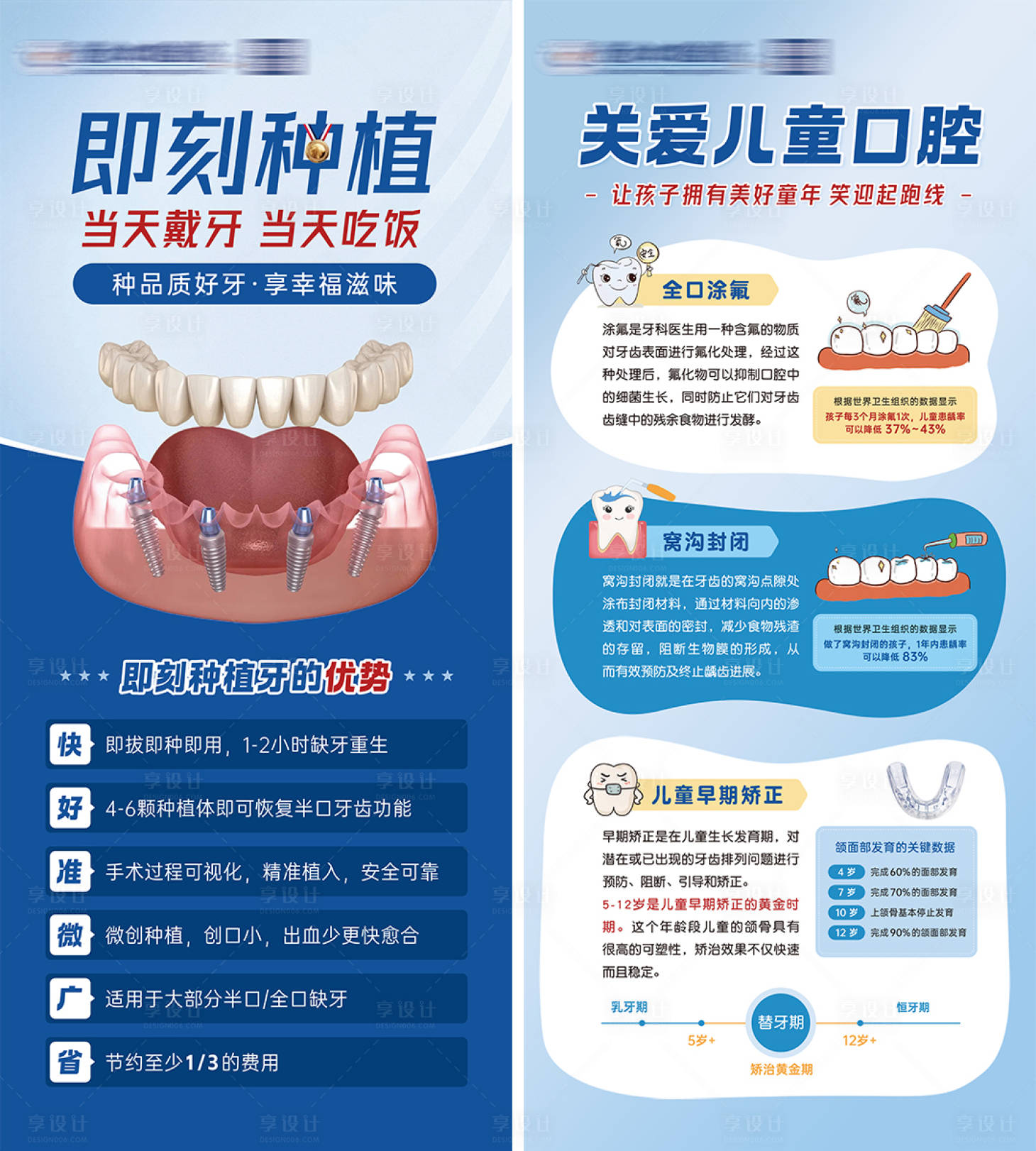 源文件下载【享设计】搜索编号：37890034886629321【即刻种植牙儿牙易拉宝展架】