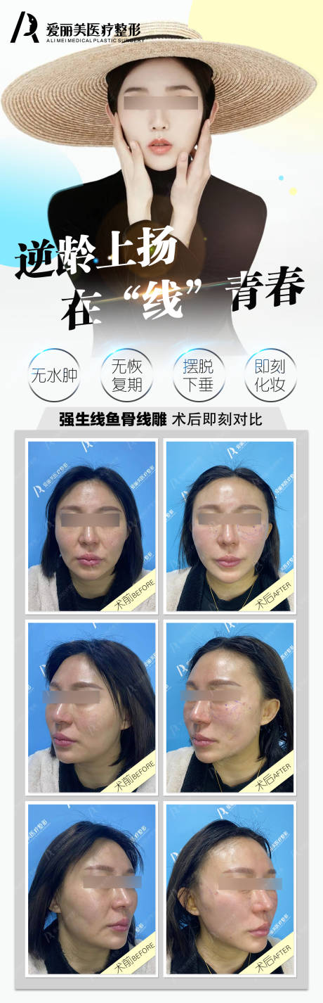 源文件下载【享设计】搜索编号：81540034899845131【医美抗衰提升案例长图海报】