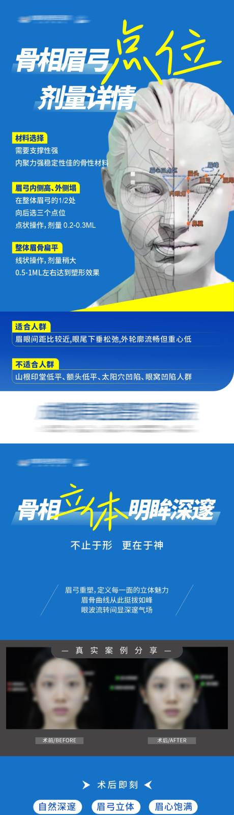 源文件下载【享设计】搜索编号：98030034852087158【医美骨相眉弓整形塑美科普系列海报】