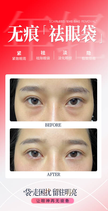 源文件下载【享设计】搜索编号：68010034916544863【无痕祛眼袋】